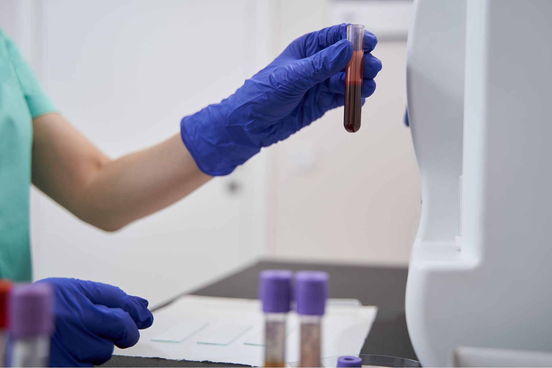 LO QUE TU SANGRE DICE DE TI: LA IMPORTANCIA DEL CHEQUEO GENERAL